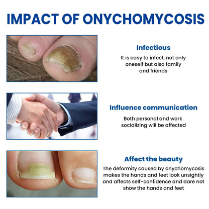 Fungus Nail Repair Patches 60pcs