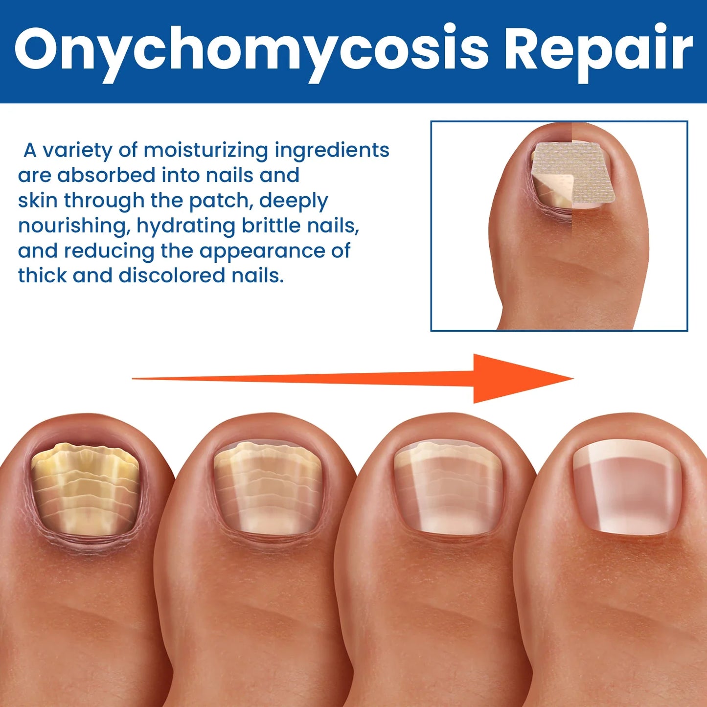 Fungus Nail Repair Patches 60pcs